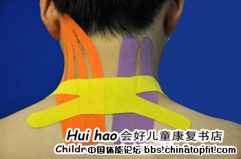 psbCAPILMD4.jpg